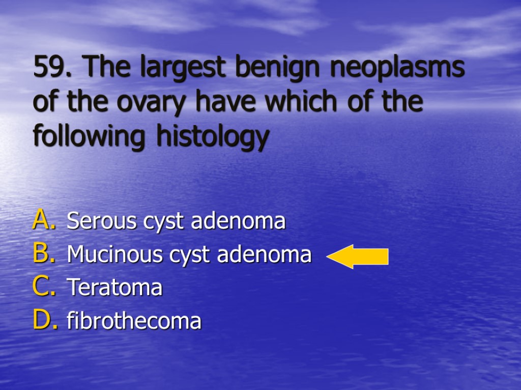 59. The largest benign neoplasms of the ovary have which of the following histology